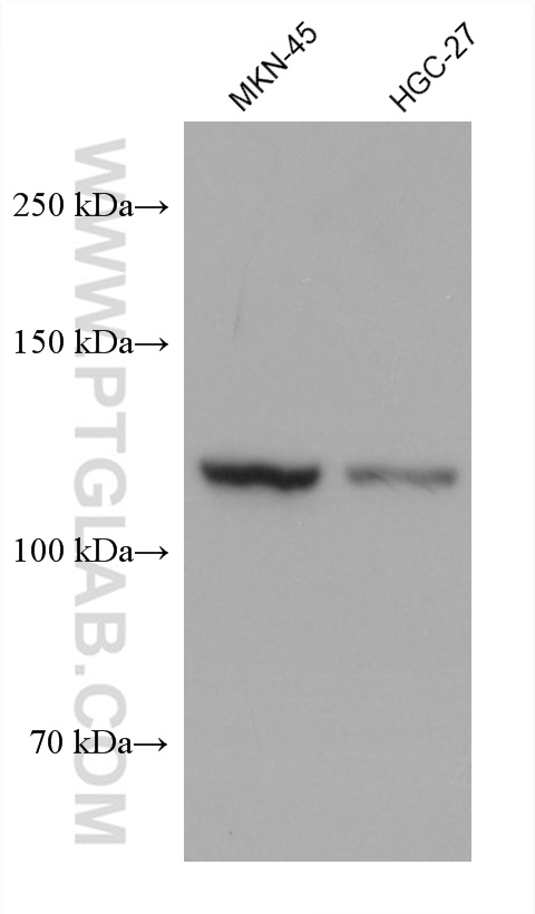 Vinculin