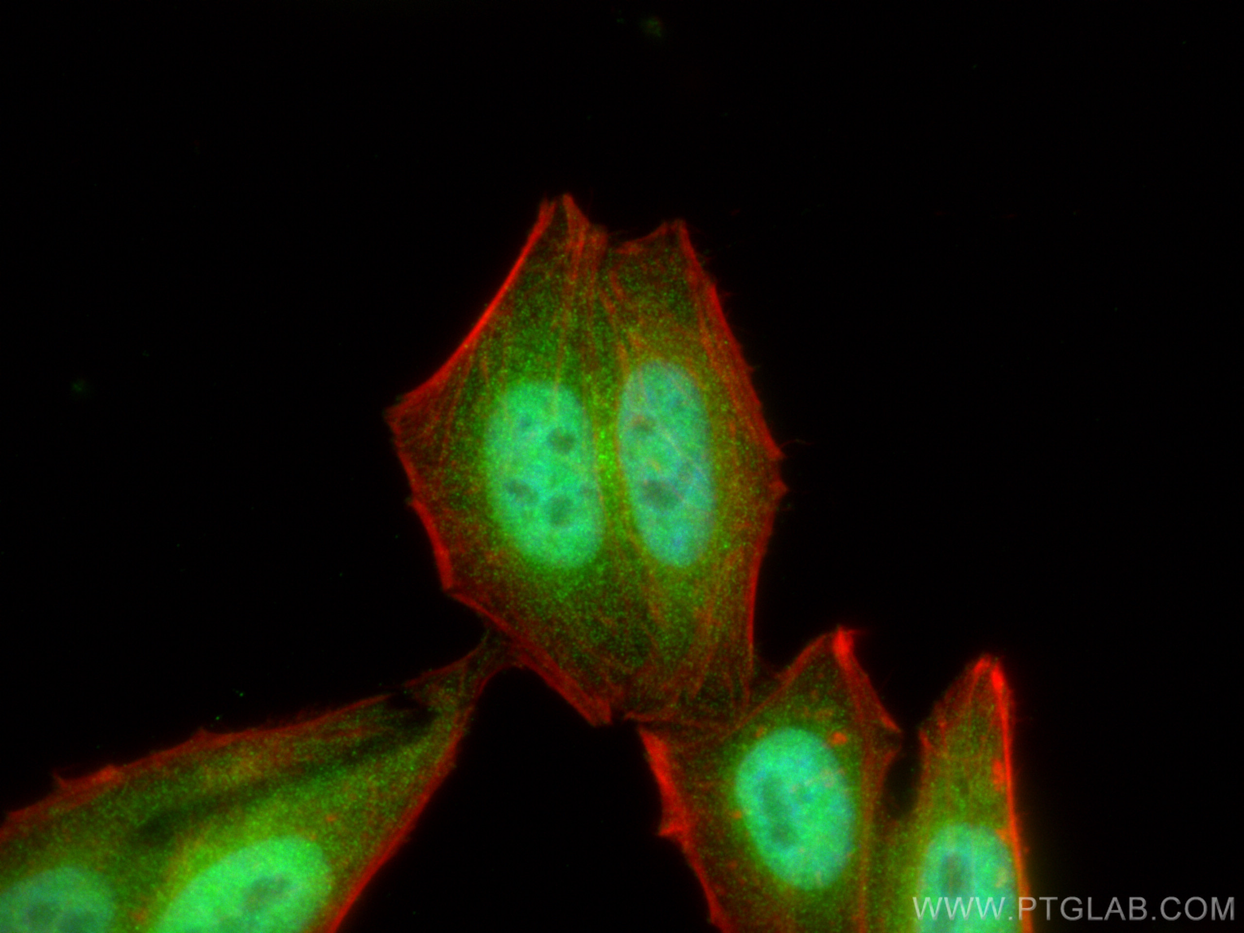 IF Staining of HepG2 using 16370-1-AP