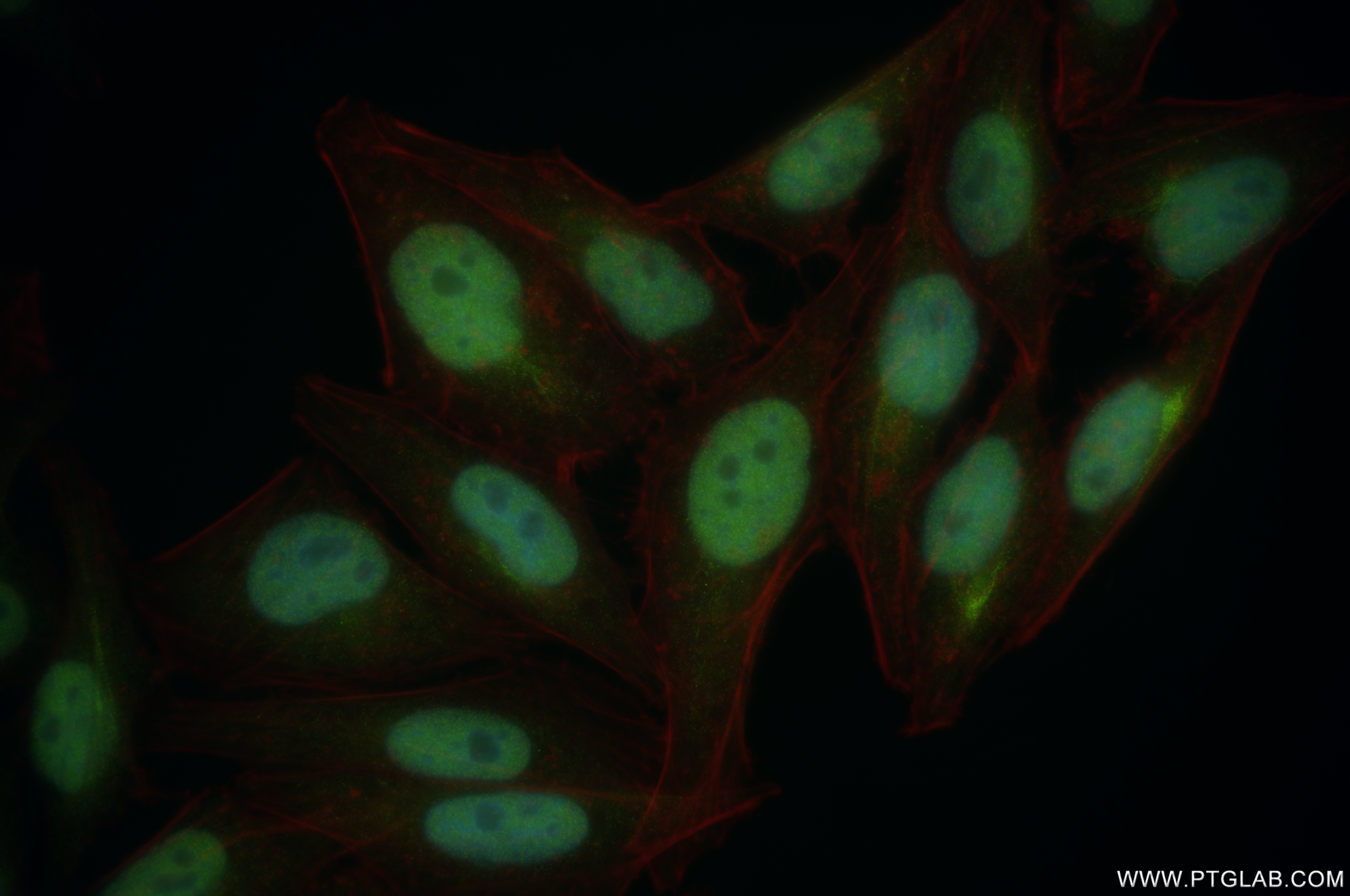 IF Staining of HepG2 using 84877-5-RR