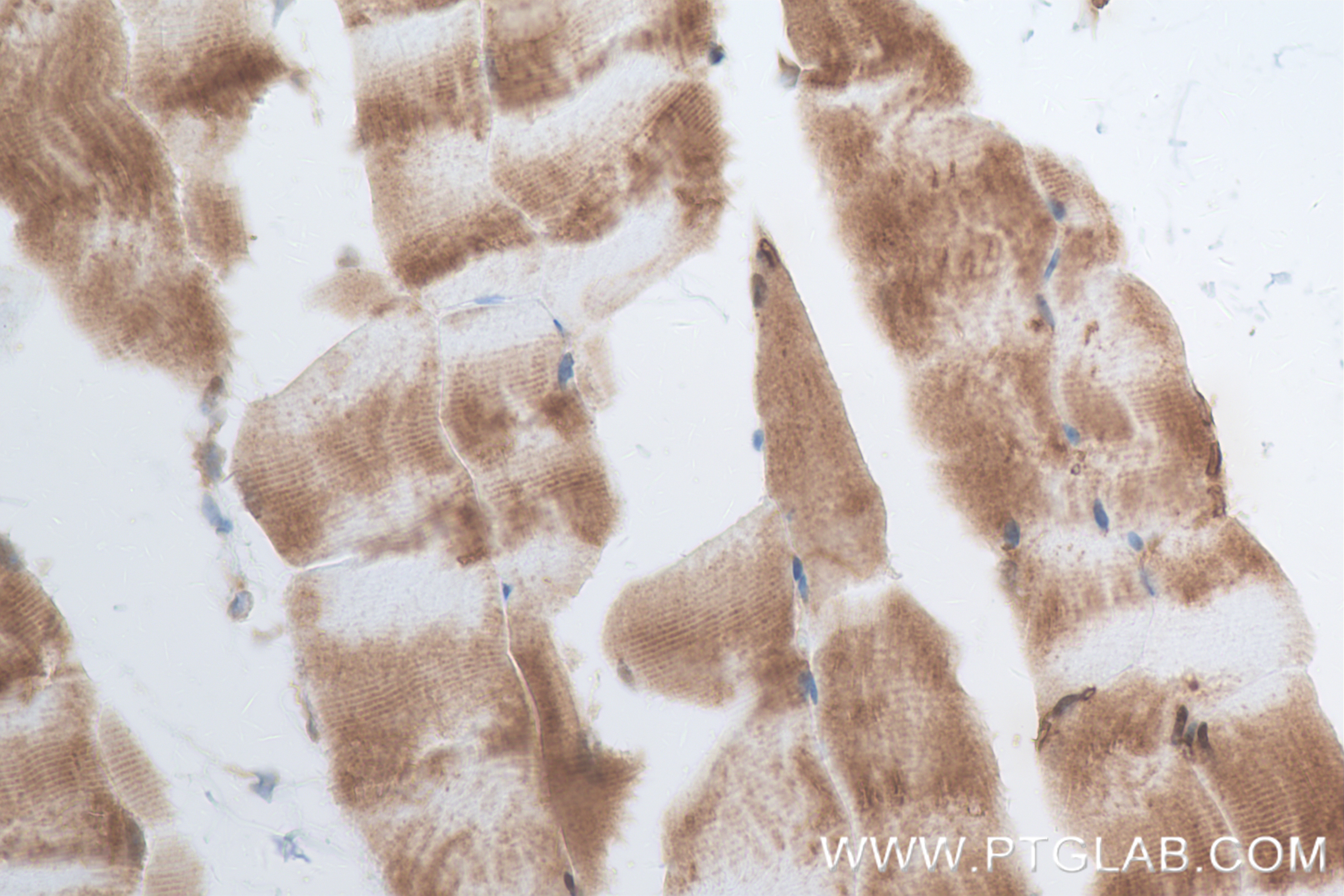 IHC staining of mouse skeletal muscle using 84877-5-RR