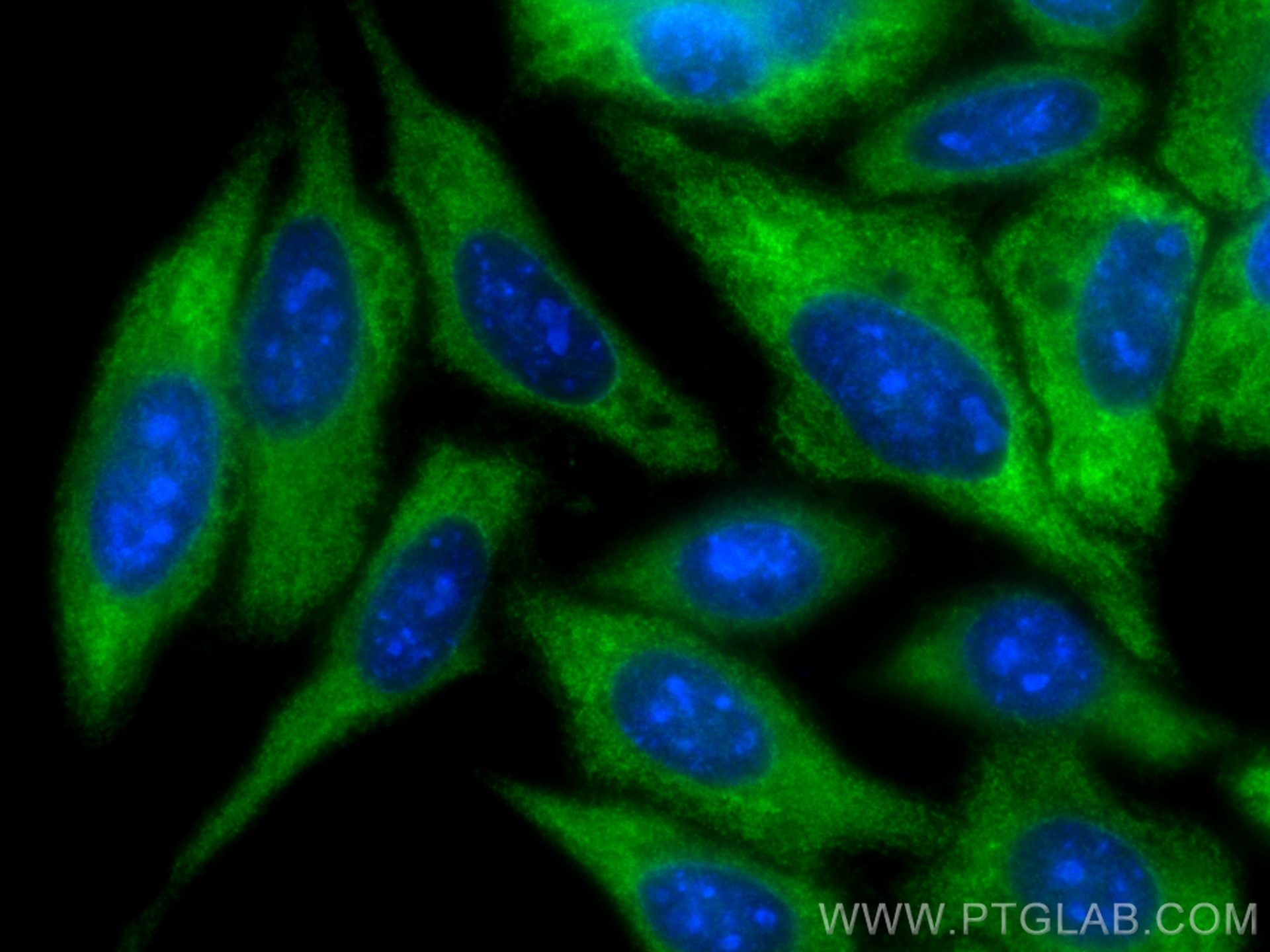 IF Staining of HepG2 using 16081-1-AP