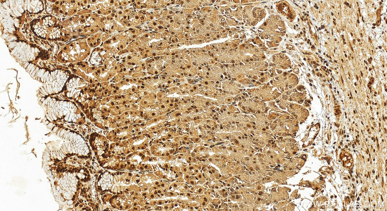 IHC staining of human stomach using 13944-1-AP