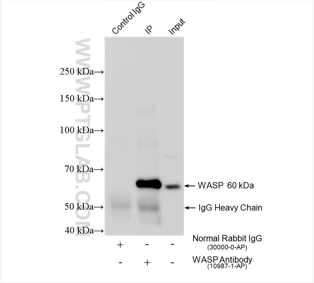 IP experiment of Raji using 10987-1-AP