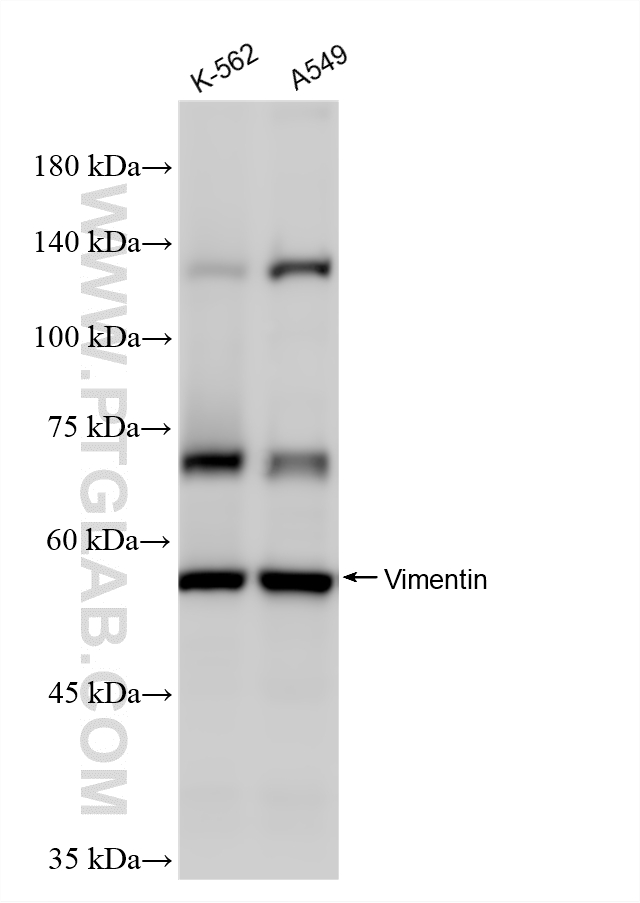 Various lysates were subjected to SDS PAGE followed by western blot with Biotin-60330 (Biotin-conjugated Vimentin Monoclonal antibody) and HRP-PF00030 (Streptavidin antibody) at dilution of 1:1000 incubated at room temperature for 1.5 hours.