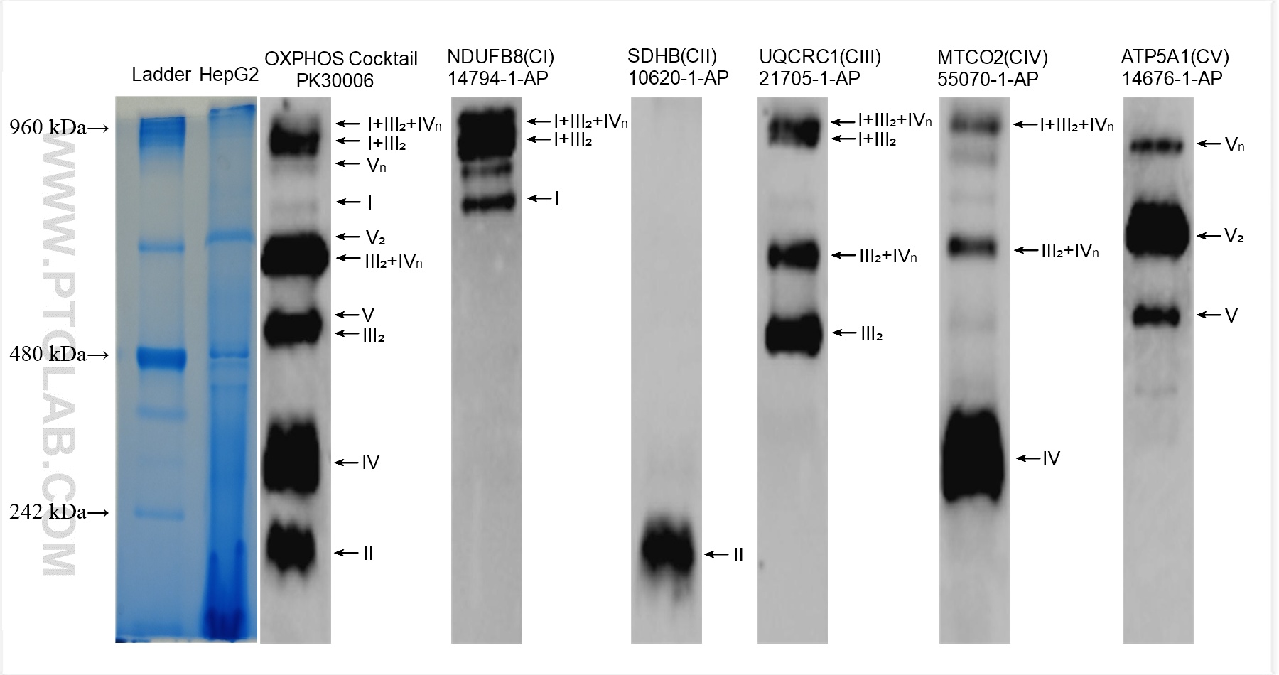 Blue Native PAGE showing oxidative phosphorylation (OXPHOS) complexes and super complexes in mitochondria. HepG2 cell lysates were subjected to BN PAGE followed by western blot with  PK30006 (OXPHOS Cocktail (Human recommended)) at dilution of 1:5000 and antibodies to each complex incubated at room temperature for 1.5 hours.