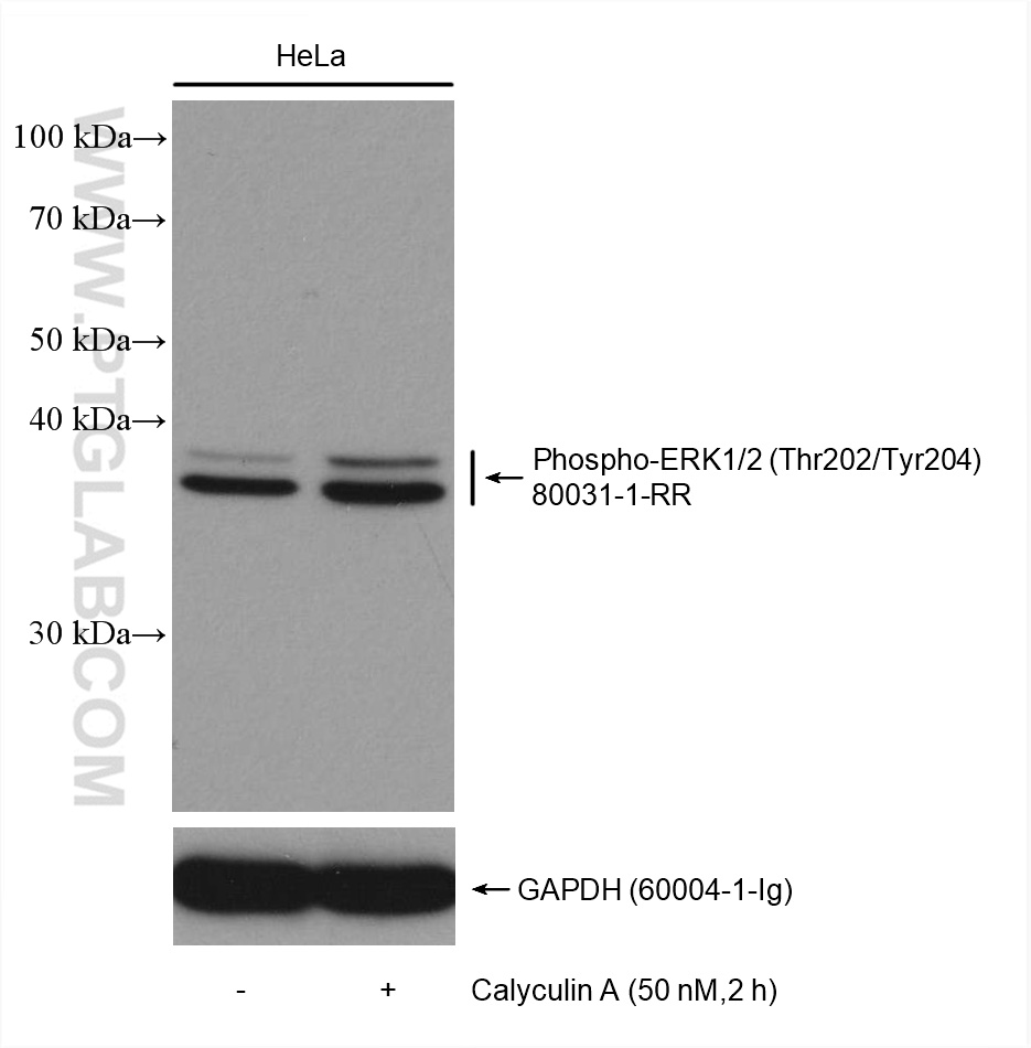 Non-treated HeLa and Calyculin A treated HeLa cells  were subjected to SDS PAGE followed by western blot with 80031-1-RR (Phospho-ERK1/2 (Thr202/Tyr204) antibody) at dilution of 1:5000 incubated at room temperature for 1.5 hours.