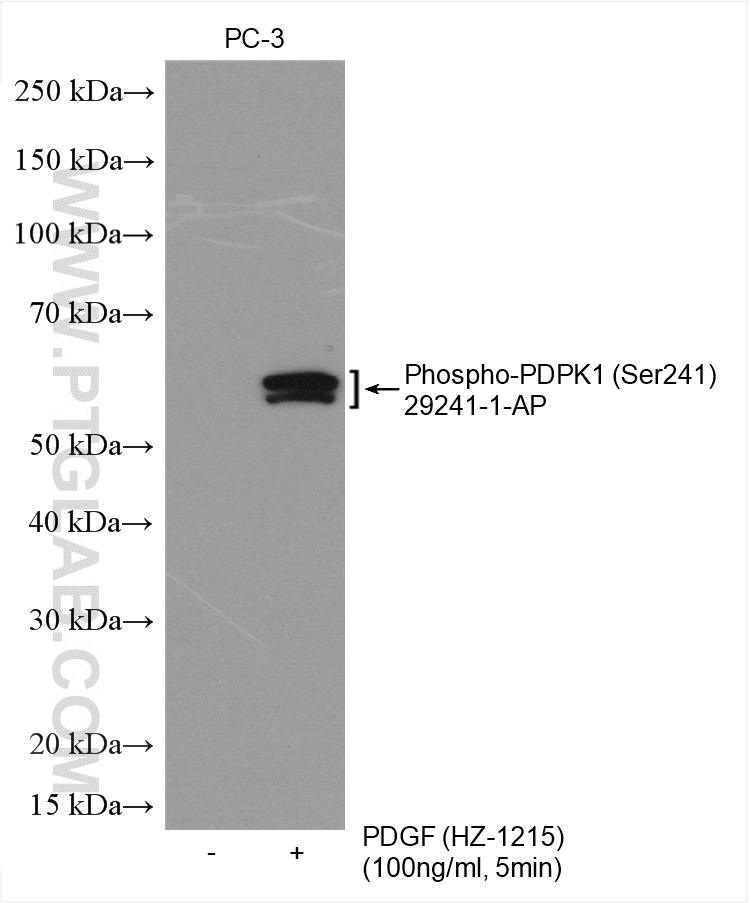 Non-treated PC-3 and PDGF (HZ-1215) treated PC-3 cells were subjected to SDS PAGE followed by western blot with 29241-1-AP (Phospho-PDPK1 (Ser241) antibody) at dilution of 1:1000 incubated at 4℃ overnight.