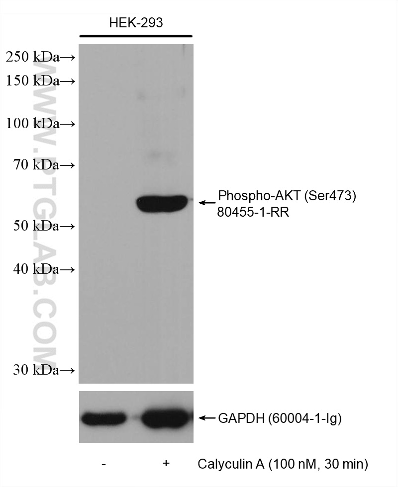 Non-treated and Calyculin A treated HEK-293 cells were subjected to SDS PAGE followed by western blot with 80455-1-RR (Phospho-AKT (Ser473) antibody) at dilution of 1:10000 incubated at room temperature for 1.5 hours. The membrane was stripped and re-blotted with GAPDH antibody as loading control.