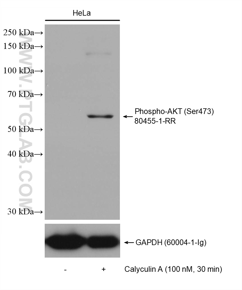 Non-treated and Calyculin A treated HeLa cells were subjected to SDS PAGE followed by western blot with 80455-1-RR (Phospho-AKT (Ser473) antibody) at dilution of 1:10000 incubated at room temperature for 1.5 hours. The membrane was stripped and re-blotted with GAPDH antibody as loading control.