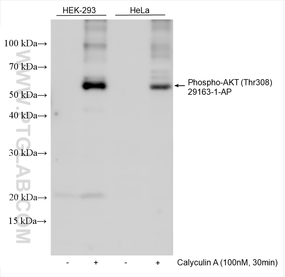 Non-treated and Calyculin A treated cells were subjected to SDS PAGE followed by western blot with 29163-1-AP (Phospho-AKT (Thr308) antibody) at dilution of 1:2000 incubated at room temperature for 1.5 hours.