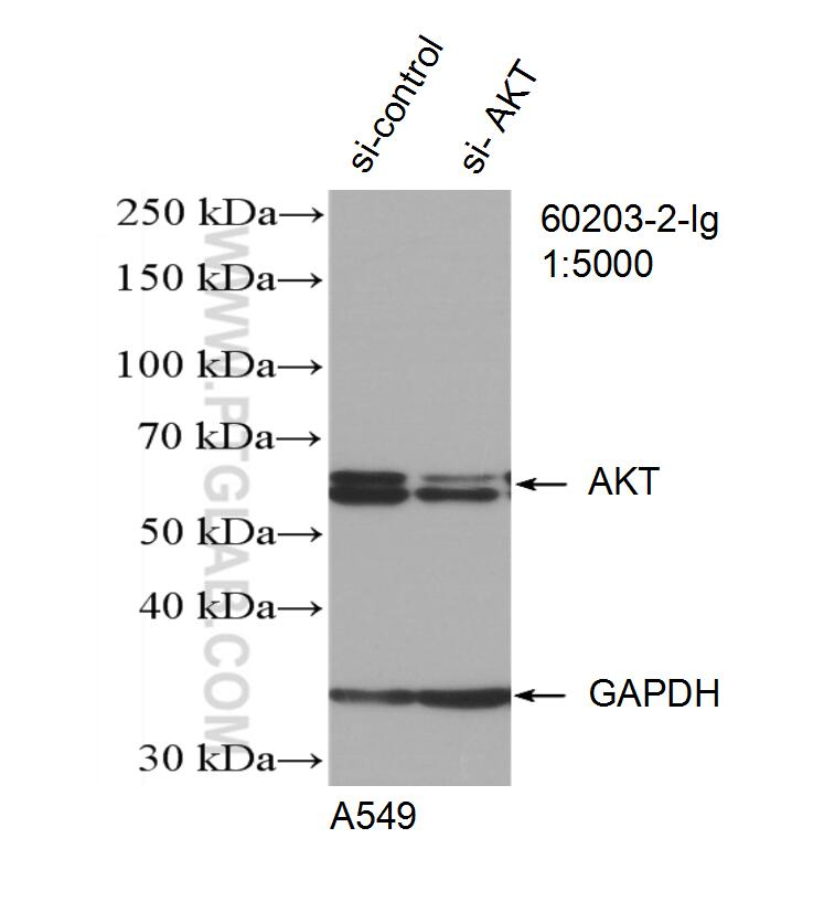 WB result of AKT antibody (60203-2-Ig; 1:5000; incubated at room temperature for 1.5 hours) with sh-Control and sh-AKT transfected A549 cells.