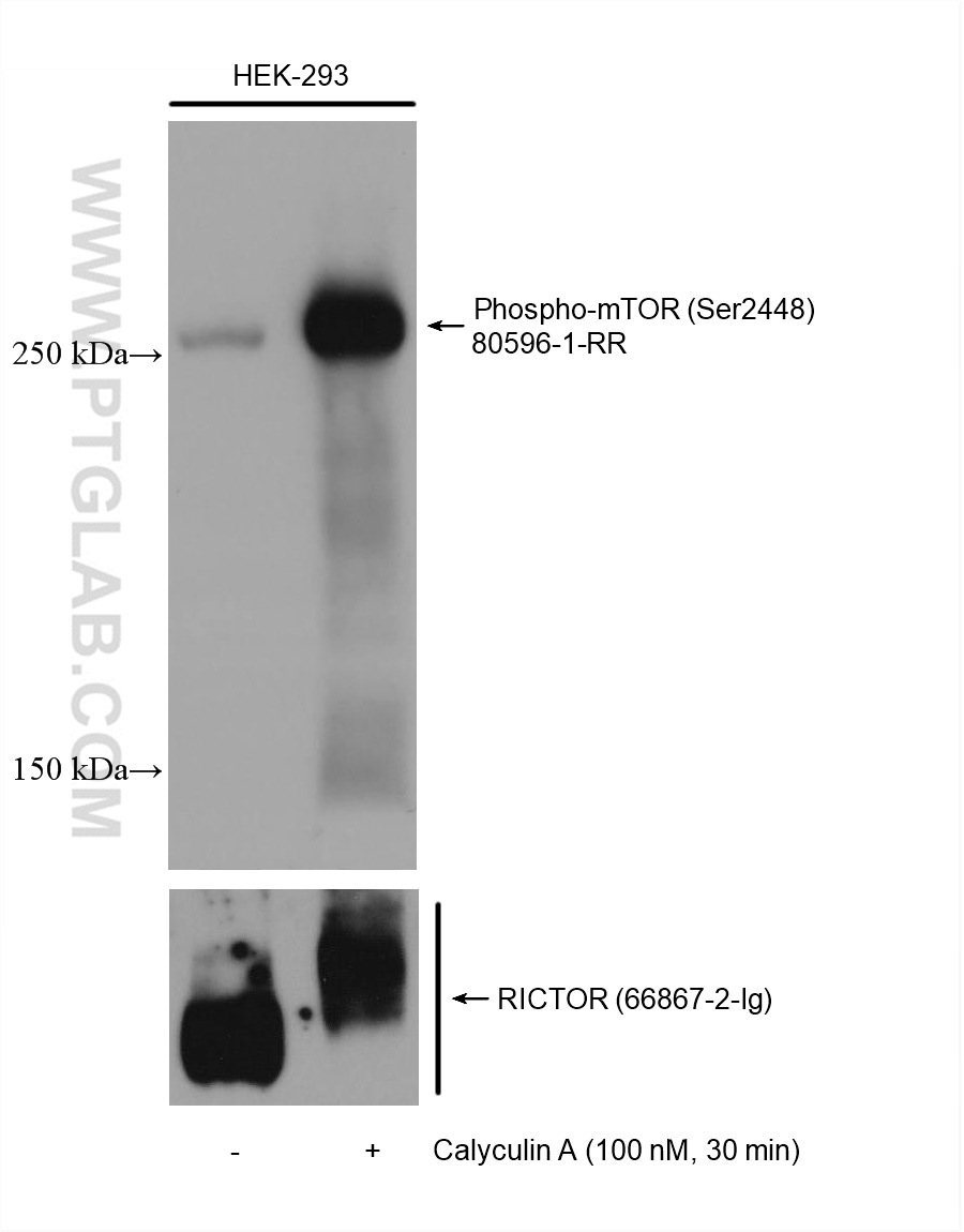 Non-treated and Calyculin A treated HEK-293 cells were subjected to SDS PAGE followed by western blot with 80596-1-RR (Phospho-mTOR (Ser2448) antibody) at dilution of 1:10000 incubated at room temperature for 1.5 hours. The membrane was stripped and re-blotted with RICTOR antibody (66867-2-Ig) subsequently.