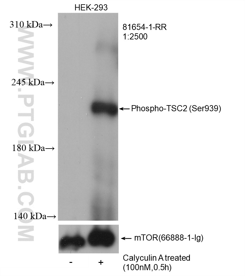 Non-treated and Calyculin A treated HEK-293 cells were subjected to SDS PAGE followed by western blot with 81654-1-RR (Phospho-TSC2 (Ser939) antibody) at dilution of 1:2500 incubated at room temperature for 1.5 hours. The membrane was stripped and re-blotted with mTOR antibody (66888-1-Ig) as the loading control.
