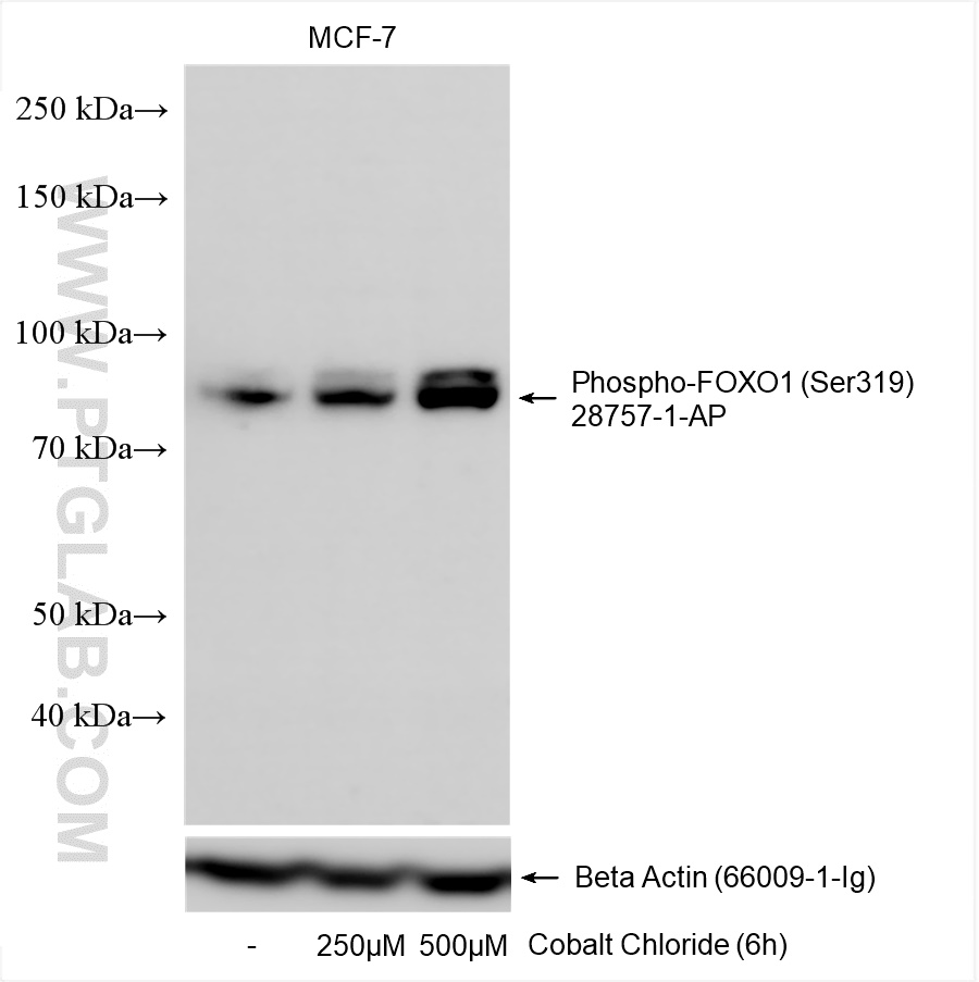 Non-treated MCF-7 cells and Cobalt Chloride treated MCF-7 cells were subjected to SDS PAGE followed by western blot with 28757-1-AP (Phospho-FOXO1 (Ser319) antibody) at dilution of 1:500 incubated at room temperature for 1.5 hours. The membrane was stripped and re-blotted with Beta Actin antibody as loading control.