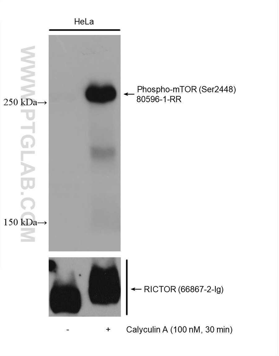 Non-treated and Calyculin A treated HeLa cells were subjected to SDS PAGE followed by western blot with 80596-1-RR (Phospho-mTOR (Ser2448) antibody) at dilution of 1:10000 incubated at room temperature for 1.5 hours. The membrane was stripped and re-blotted with RICTOR antibody (66867-2-Ig) subsequently.