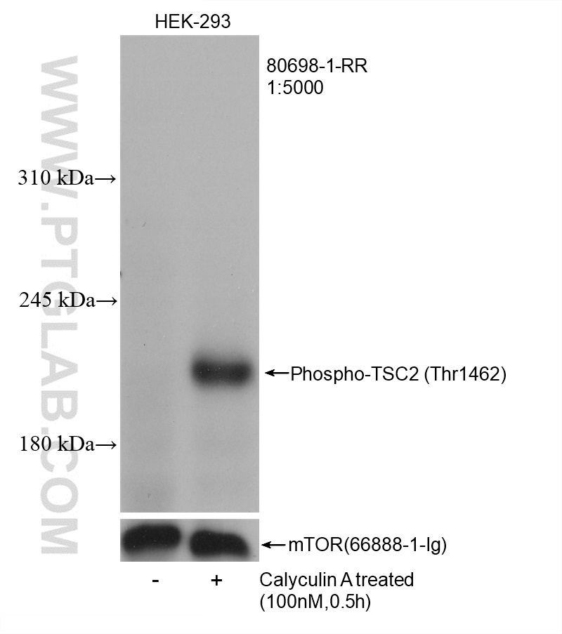 Non-treated and Calyculin A treated HEK-293 cells were subjected to SDS PAGE followed by western blot with 80698-1-RR (Phospho-TSC2 (Thr1462) antibody) at dilution of 1:5000 incubated at room temperature for 1.5 hours. The membrane was stripped and re-blotted with mTOR antibody (66888-1-Ig) as the loading control.