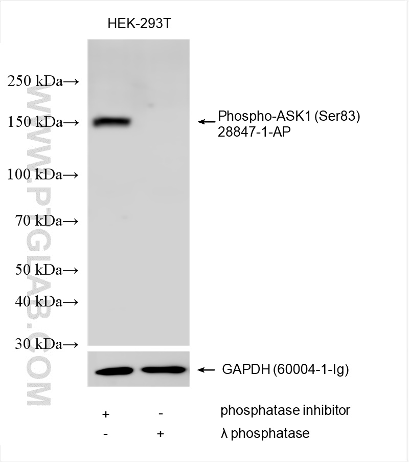 Phosphatase inhibitor treated and λ phosphatase treated HEK-293T cells were subjected to SDS PAGE followed by western blot with 28847-1-AP (Phospho-ASK1 (Ser83) antibody) at dilution of 1:1000 incubated at room temperature for 1.5 hours. The membrane was stripped and re-blotted with GAPDH antibody as loading control.