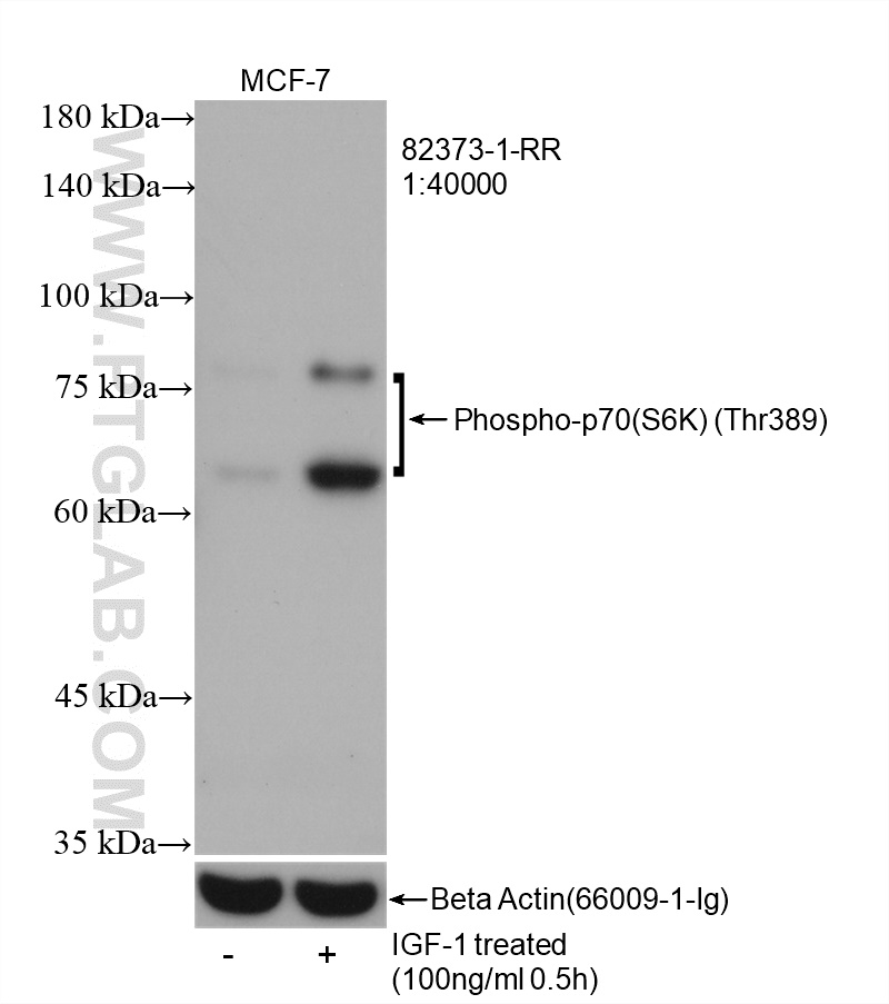 Non-treated and IGF-1 treated MCF-7 cells were subjected to SDS PAGE followed by western blot with 82373-1-RR (Phospho-p70(S6K) (Thr389) antibody) at dilution of 1:40000 incubated at room temperature for 1.5 hours. The membrane was stripped and re-blotted with beta actin antibody (66009-1-Ig) as loading control.