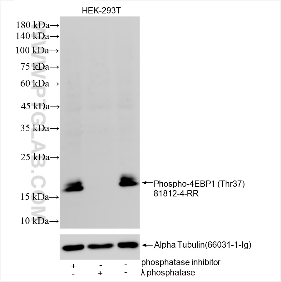 Non-treated HEK-293T cells, phosphatase inhibitor treated HEK-293T cells and λ phosphatase treated HEK-293T cells were subjected to SDS PAGE followed by western blot with 81812-4-RR (Phospho-4EBP1 (Thr37) antibody) at dilution of 1:2000 incubated at room temperature for 1.5 hours. The membrane was stripped and re-blotted with Alpha Tubulin (66031-1-Ig) antibody as a loading control.