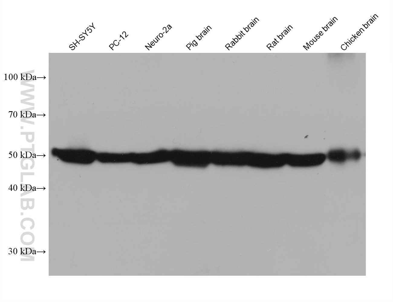 Various lysates were subjected to SDS PAGE followed by western blot with 66375-1-Ig (TUBB3-specific antibody) at dilution of 1:49000 incubated at room temperature for 1.5 hours.