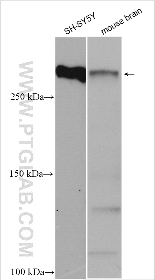 Various lysates were subjected to SDS PAGE followed by western blot with 17490-1-AP (MAP2 antibody) at dilution of 1:30000 incubated at room temperature for 1.5 hours.