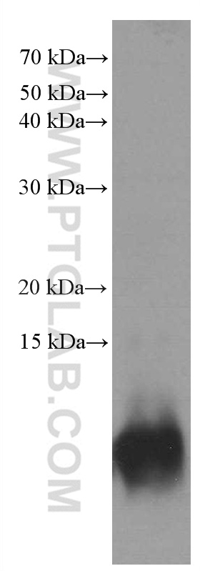 rat brain tissue were subjected to SDS PAGE followed by western blot with 66616-1-Ig (S100B antibody) at dilution of 1:2000 incubated at room temperature for 1.5 hours.