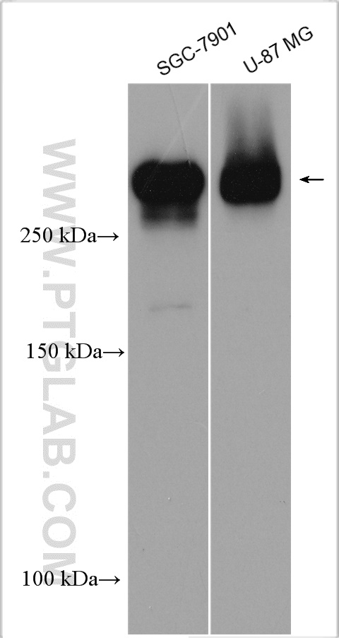 Various lysates were subjected to SDS PAGE followed by western blot with 29285-1-AP (nestin antibody) at dilution of 1:500 incubated at room temperature for 1.5 hours.