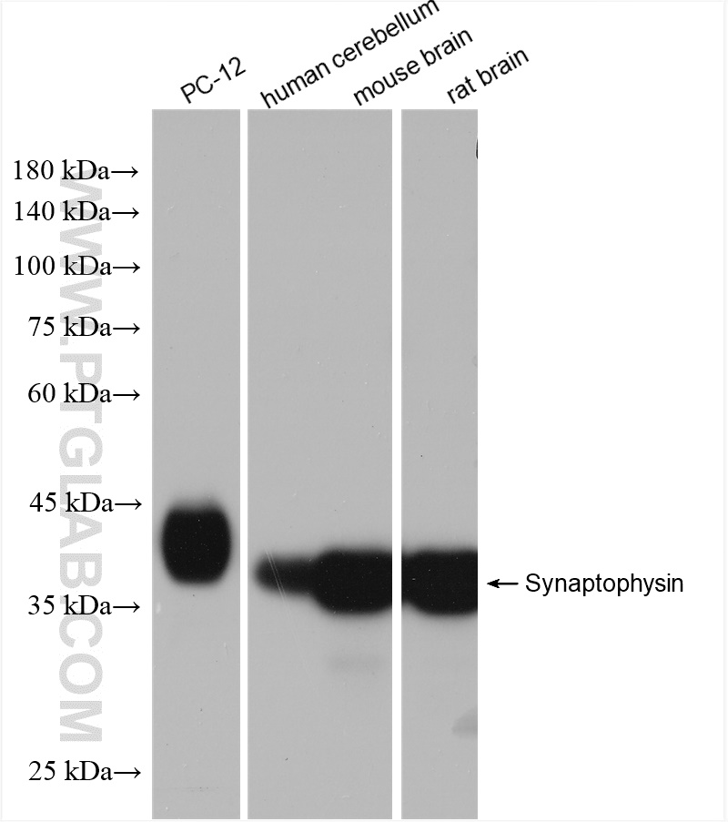 Various lysates were subjected to SDS PAGE followed by western blot with 82900-1-RR (Synaptophysin antibody) at dilution of 1:20000 incubated at room temperature for 1.5 hours.