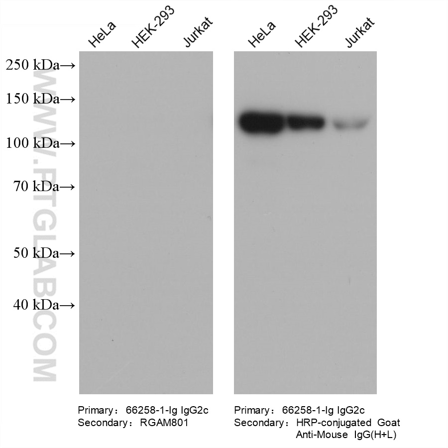 Various lysates were subjected to SDS-PAGE followed by western blot with FAK mouse monoclonal antibody (66258-1-Ig, IgG2c).  HRP-Goat Anti-Mouse IgA-Specific Recombinant Secondary Antibody (RGAM801) and Multi-rAb HRP-Goat Anti-Mouse IgG (H+L) Recombinant Secondary Antibody (RGAM001) were used at 1: 5000 for detection.  The result shows that RGAM801 does not react with mouse IgG2c.