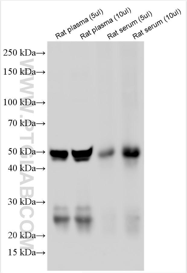 Rat plasma and rat serum were subjected to SDS PAGE followed by western blot with SA00001-10 (HRP-conjugated Affinipure Donkey Anti-Rat IgG(H+L)) at dilution of 1:10000 incubated at room temperature for 1.5 hours.