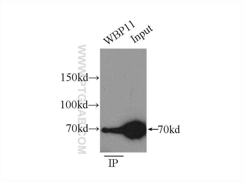 IP experiment of mouse heart using 10316-1-AP