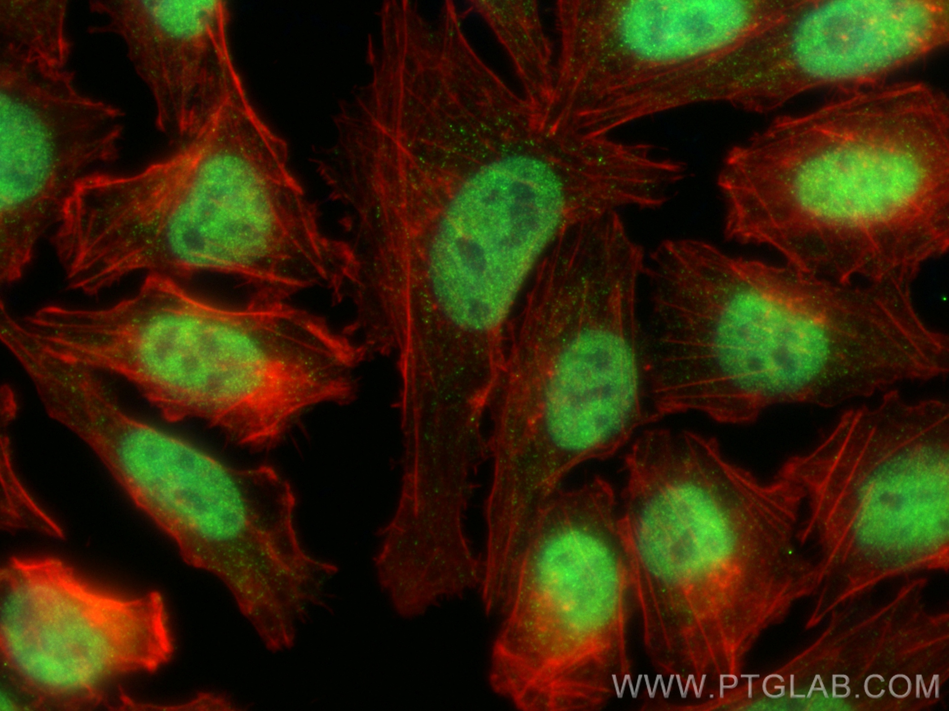 IF Staining of A375 using 12030-1-AP