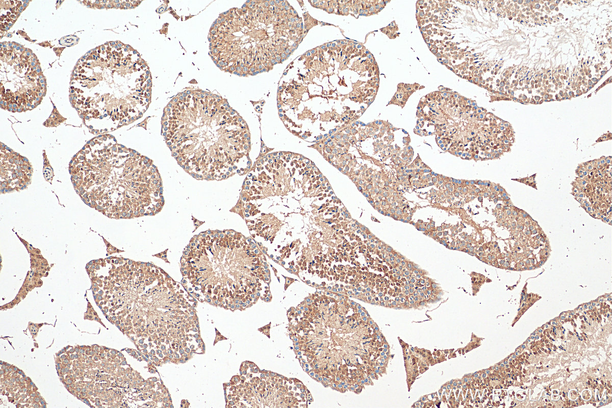 IHC staining of mouse testis using 12030-1-AP