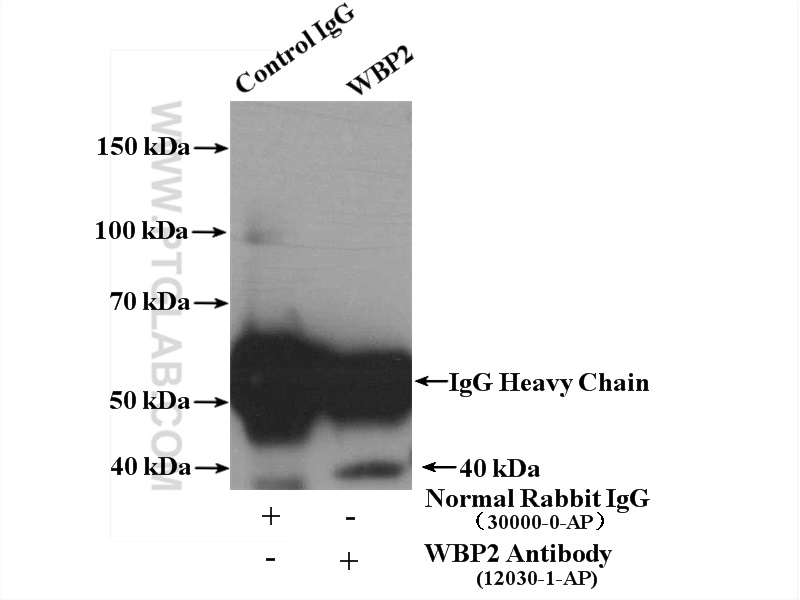 IP experiment of A375 using 12030-1-AP