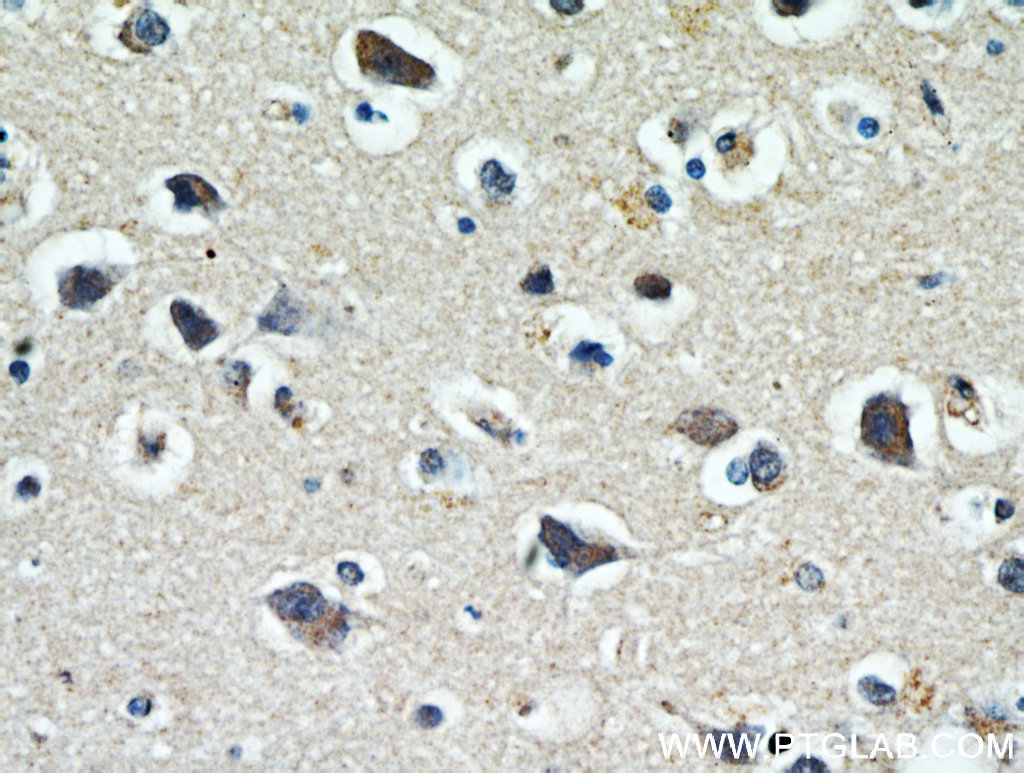 IHC staining of human brain using 21280-1-AP