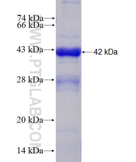 WBSCR22 fusion protein Ag28094 SDS-PAGE