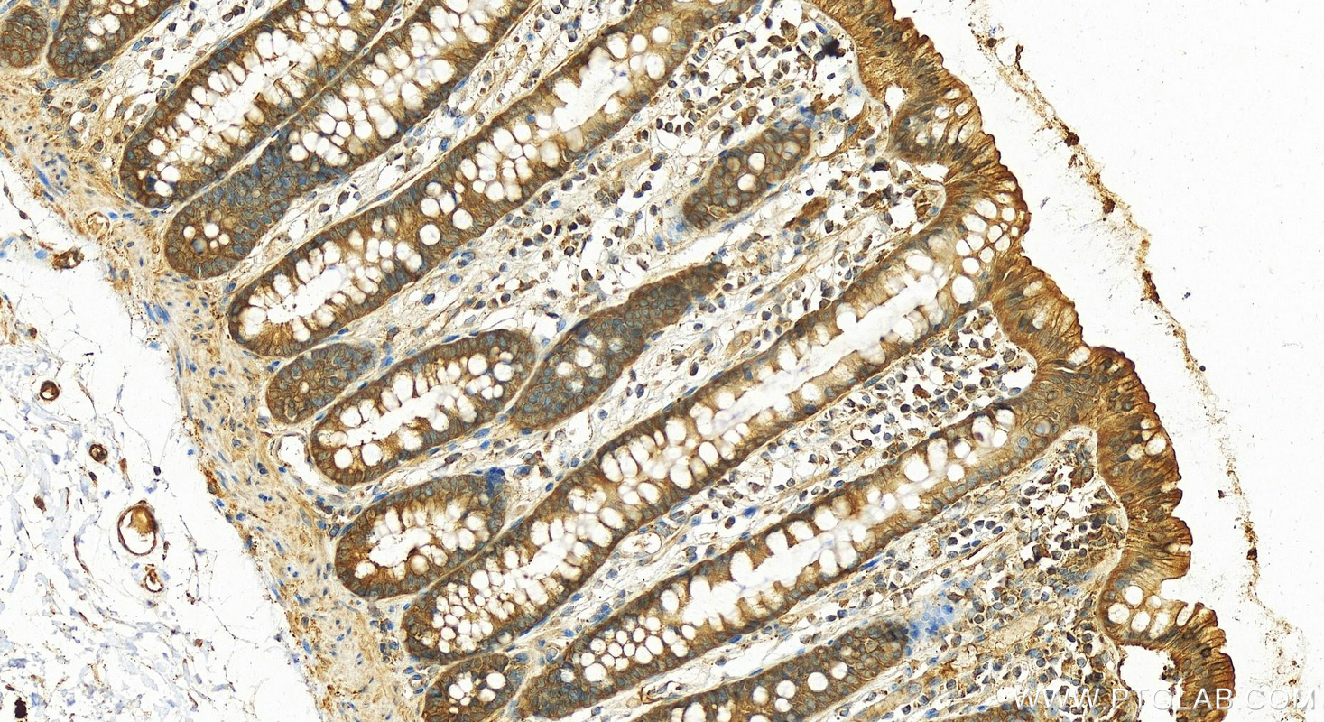 IHC staining of human colon using 13676-1-AP