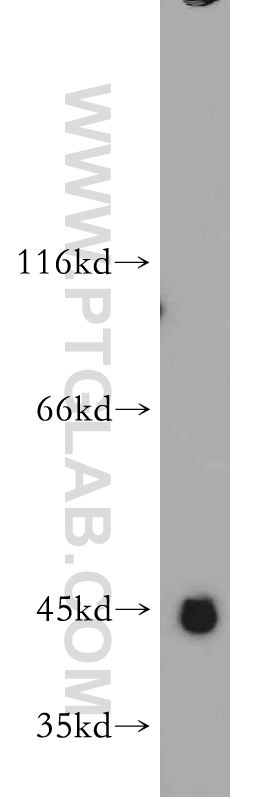 WB analysis of HEK-293 using 21571-1-AP