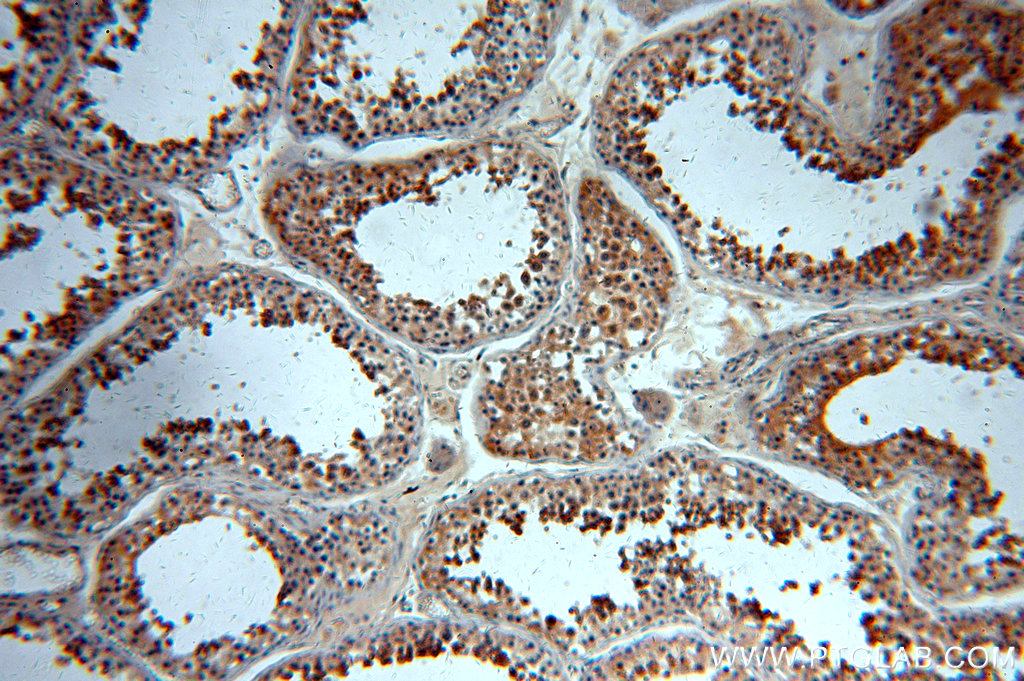 IHC staining of human testis using 20483-1-AP