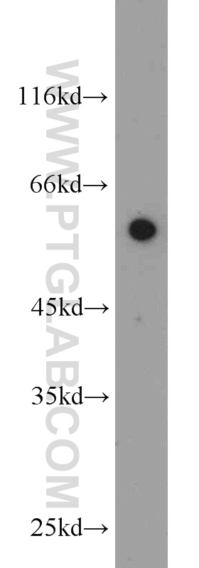 WB analysis of HeLa using 20483-1-AP