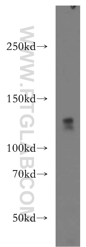 WB analysis of HeLa using 20508-1-AP