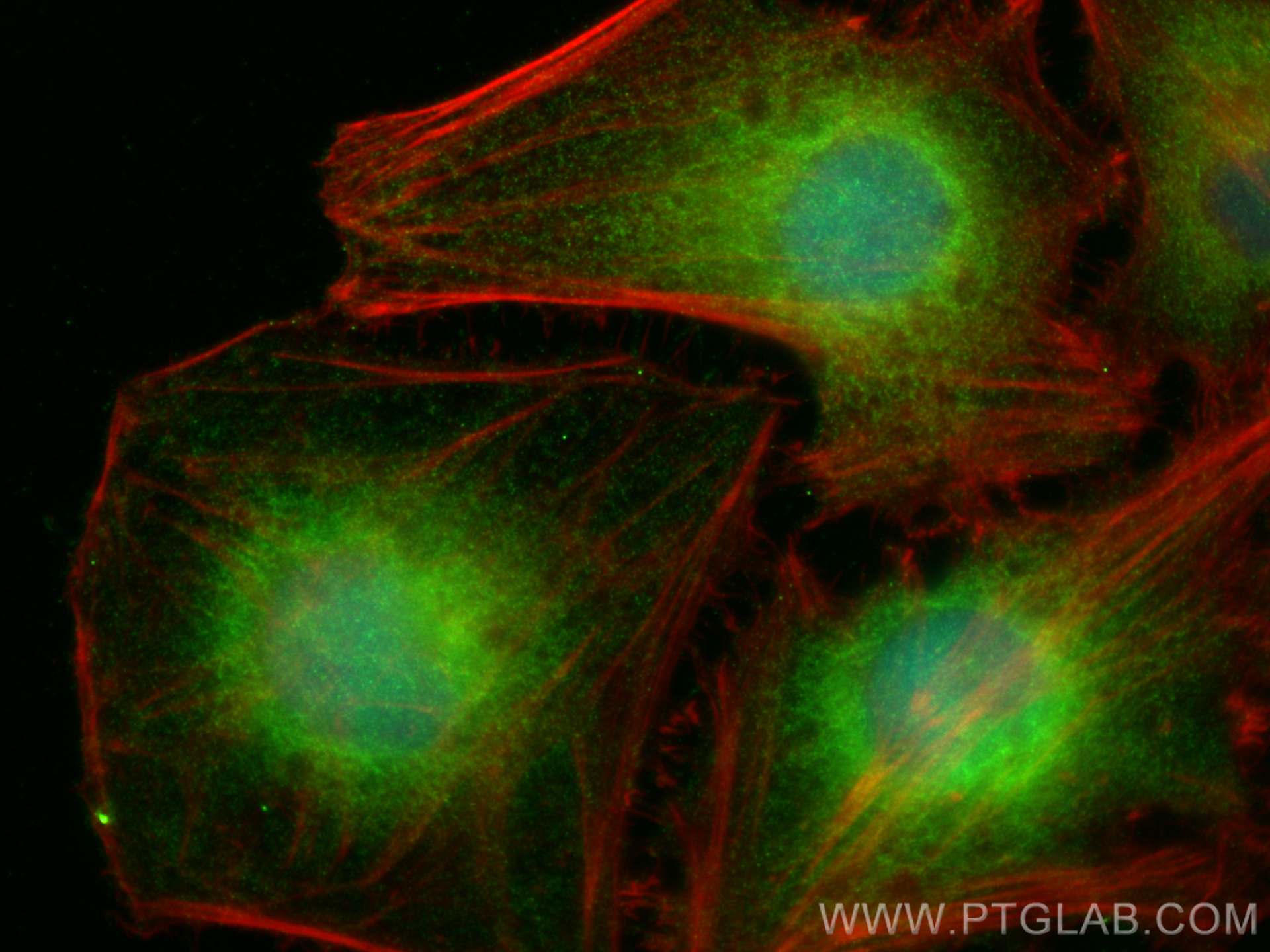 IF Staining of HeLa using 22536-1-AP