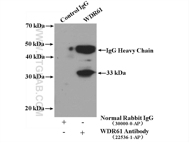 IP experiment of mouse brain using 22536-1-AP