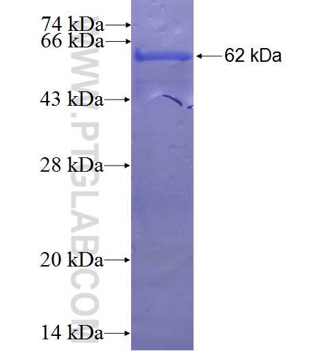 WDR69 fusion protein Ag23630 SDS-PAGE