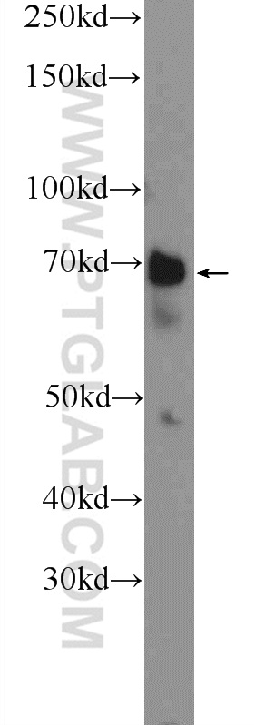 WB analysis of HeLa using 25528-1-AP