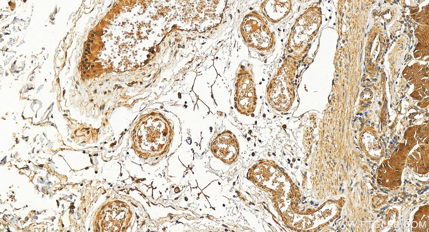 IHC staining of human stomach using 10115-1-AP