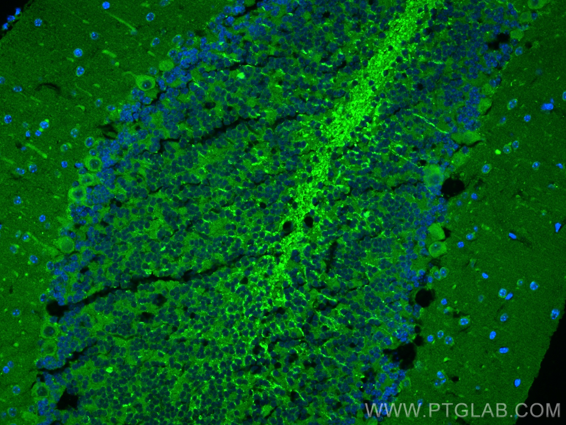 IF Staining of mouse cerebellum using 24874-1-AP