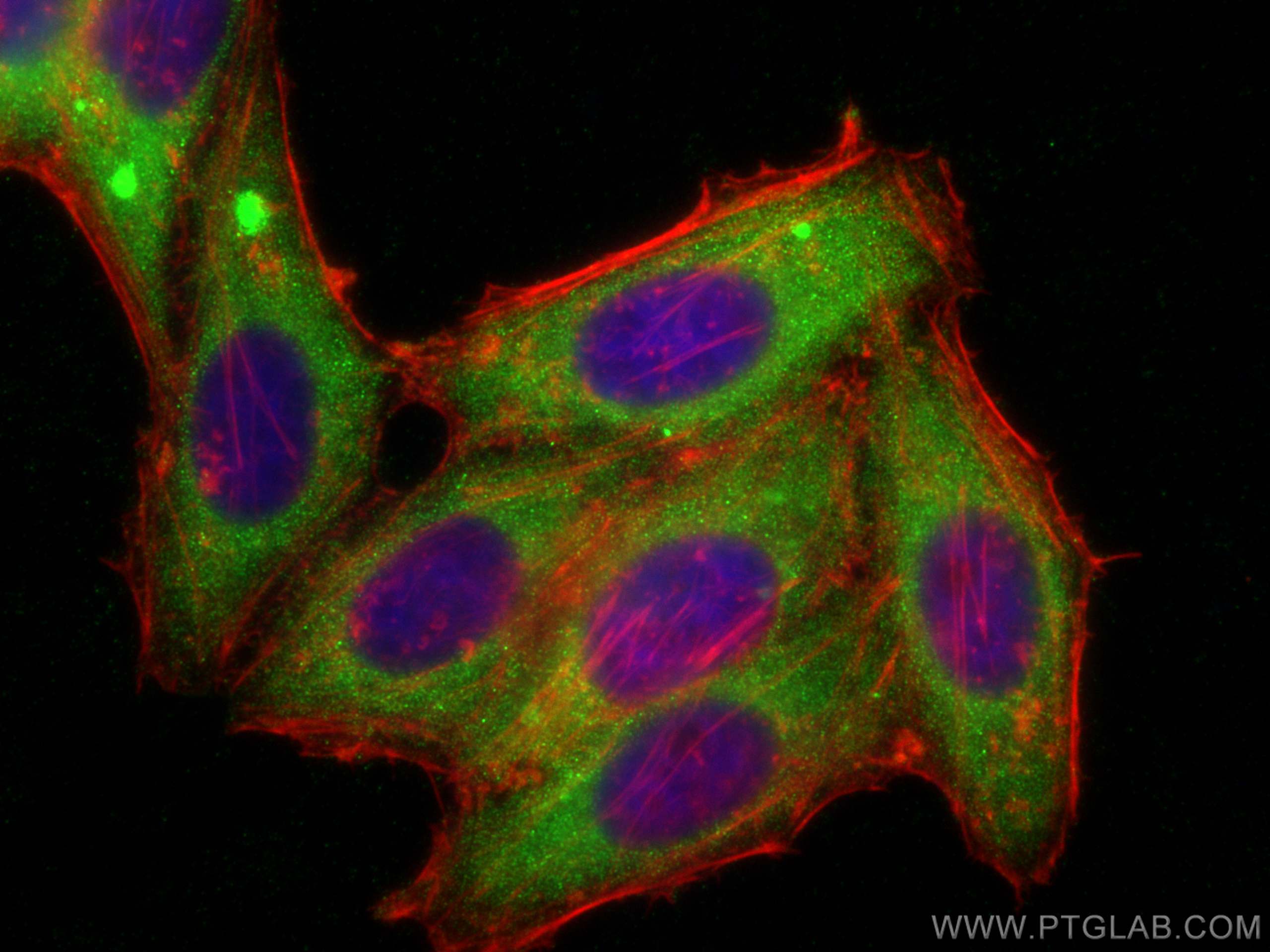 IF Staining of HepG2 using 24874-1-AP