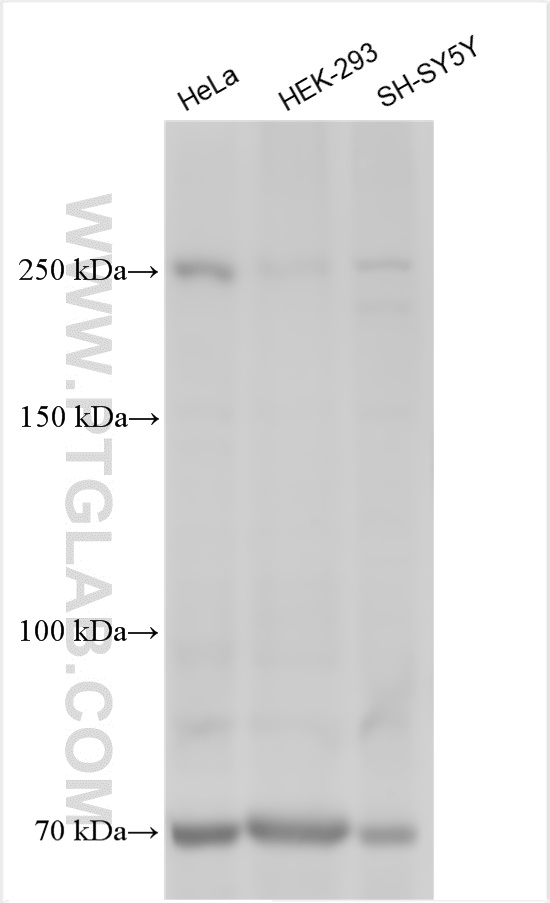 WB analysis using 24874-1-AP