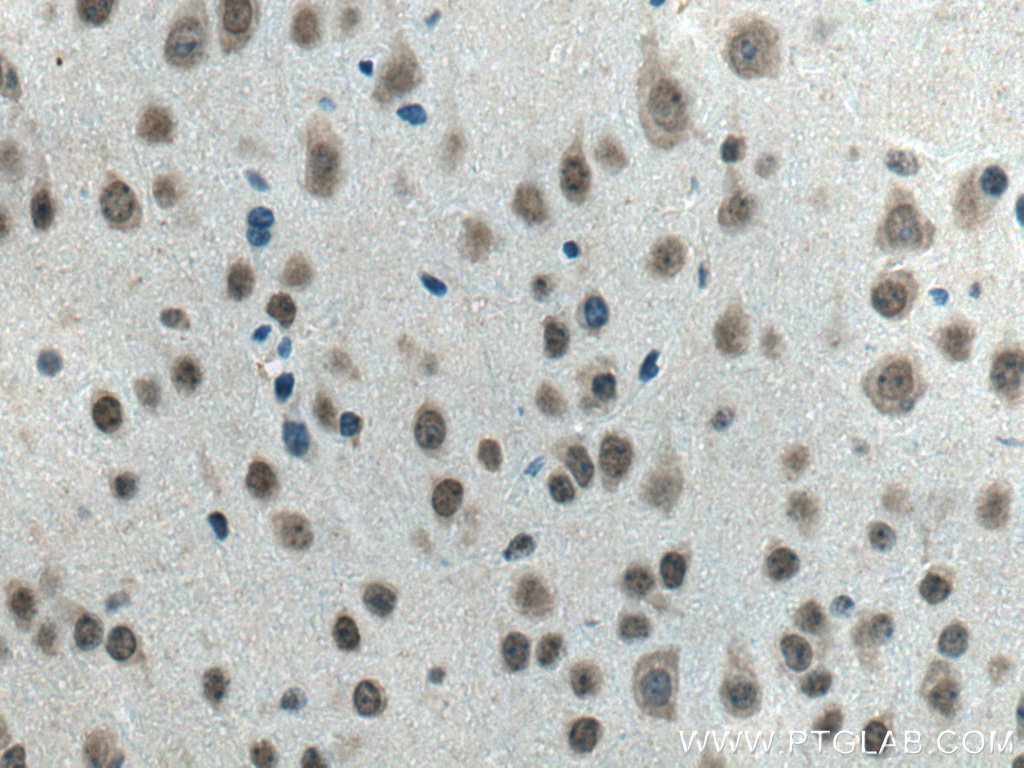 IHC staining of mouse brain using 21354-1-AP